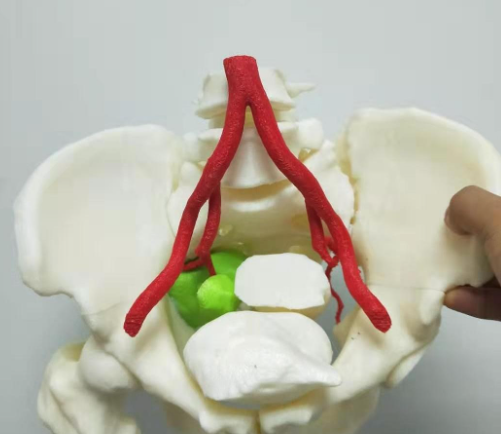 精密医疗3D打印定制，如何避免术后二次修复的麻烦